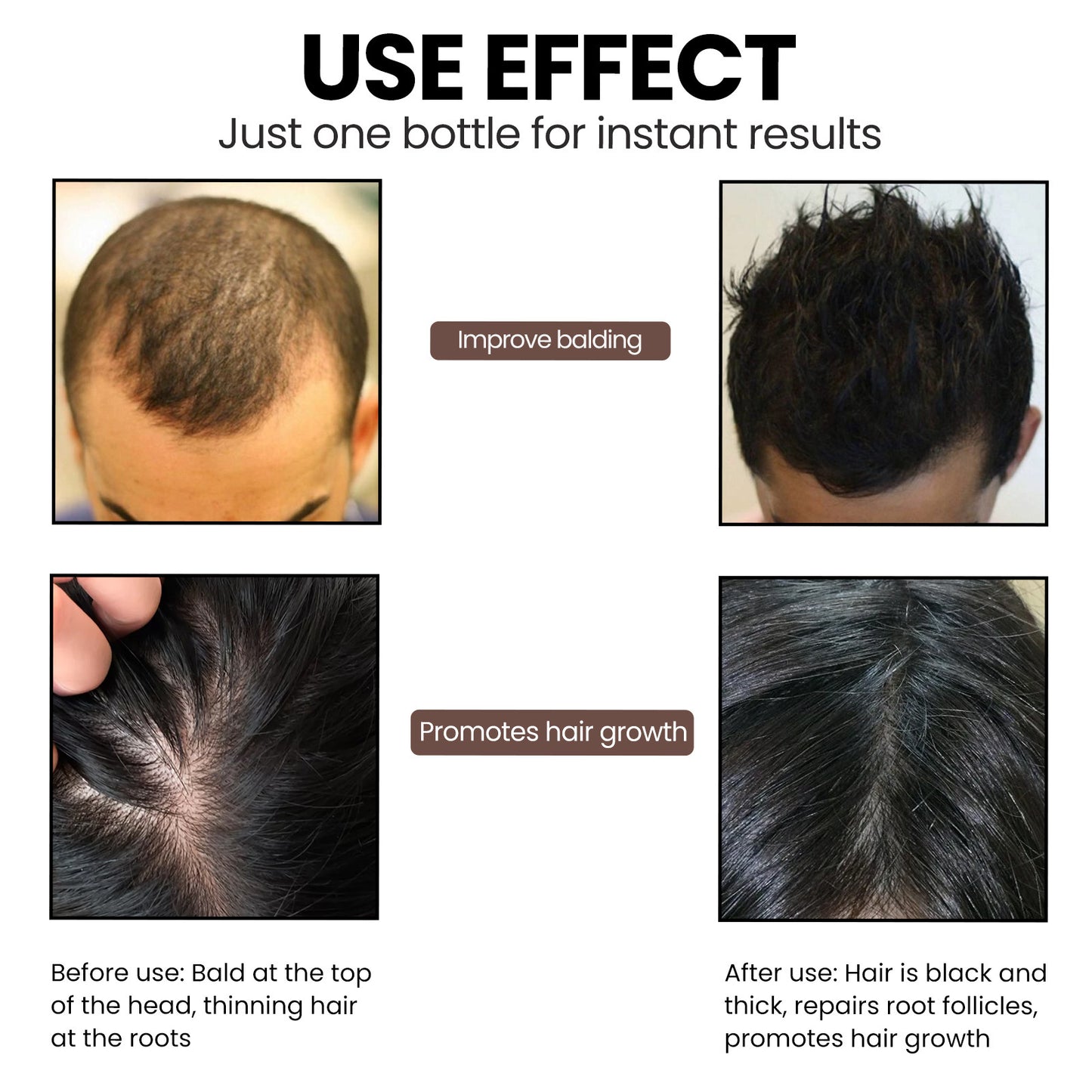 EELHOE Hair Dense Essence Hair Anti-hair Loss And Hair Fixation Nutrition